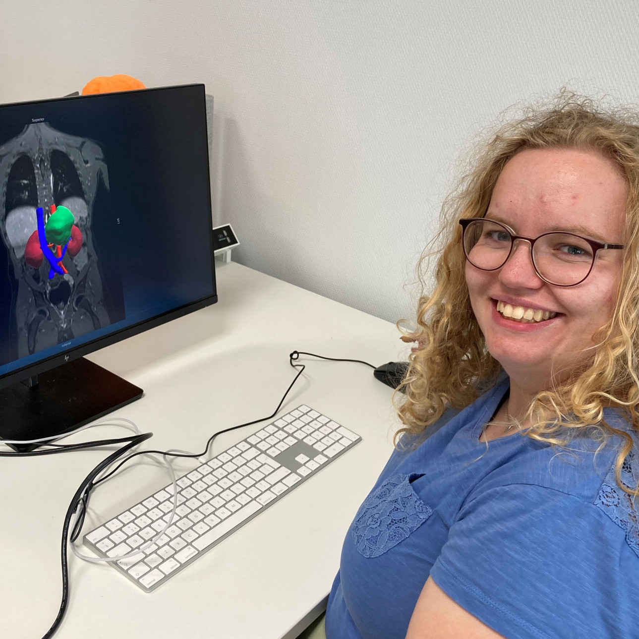 AI challenge voor verbetering operaties neuroblastoom