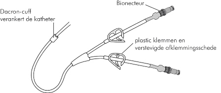 Afbeelding 1: Centraal veneuze katheter/lijn